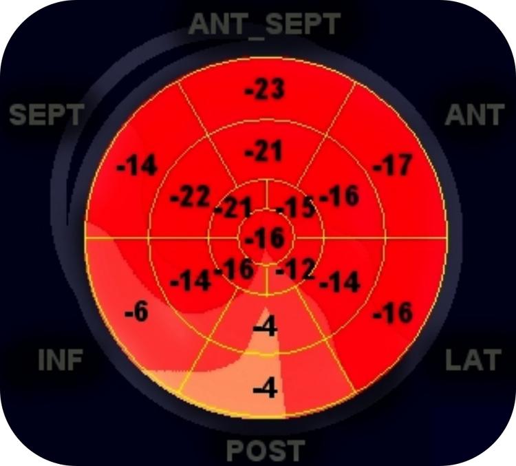 Strain Miocárdico: O que o cardiologista clínico precisa saber ? Parte 2