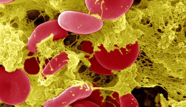 O futuro dos inibidores do fator XI