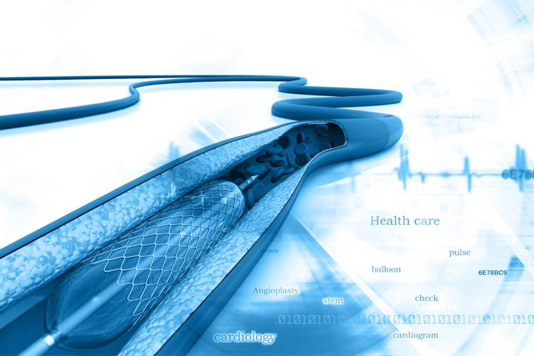 Quais as potenciais vantagens da angioplastia com balão farmacológico?