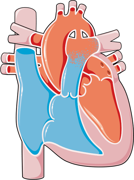 Síndrome de Eisenmenger: o que todo médico deve saber (parte 2)