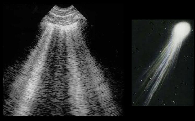 Abordagem Guiada por Problemas na Metodologia POCUS