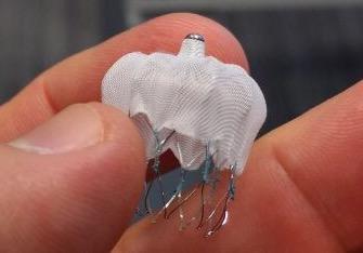 Existe espaço para o fechamento percutâneo do apêndice atrial esquerdo nos dias atuais?