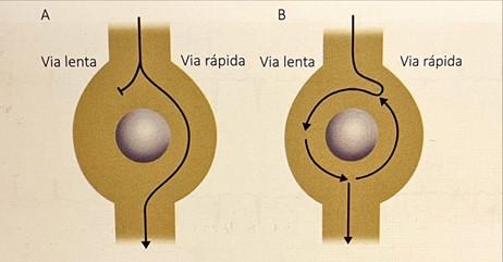 E se eu pudesse reverter minha TPSV em casa?