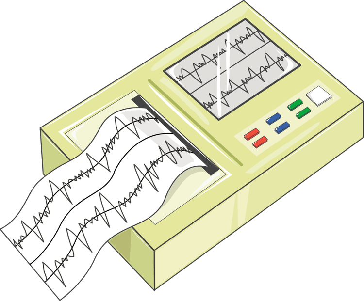 Como definir a frequência a cardíaca pelo ECG quando o ritmo cardíaco é irregular?