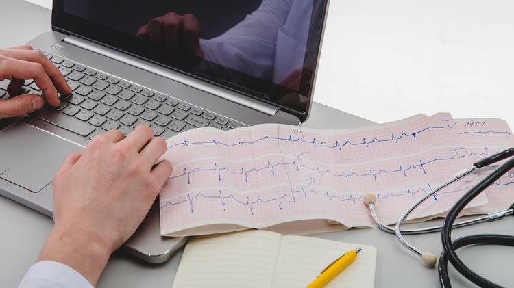 Qual a FC ideal em pacientes com FA e DAC?