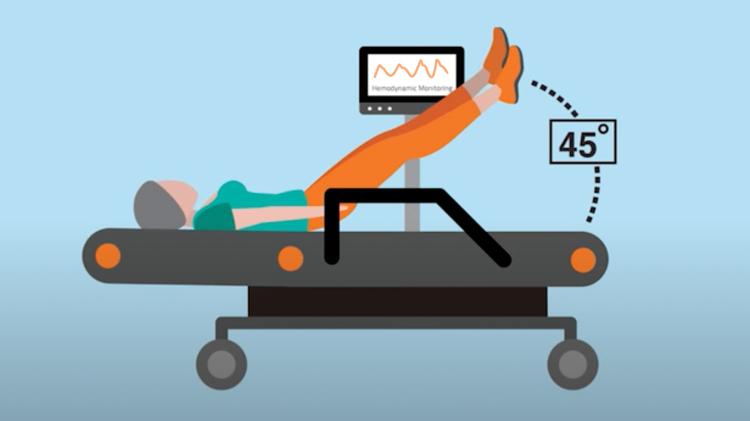 Passive Leg Raising: o que todo médico precisa saber!