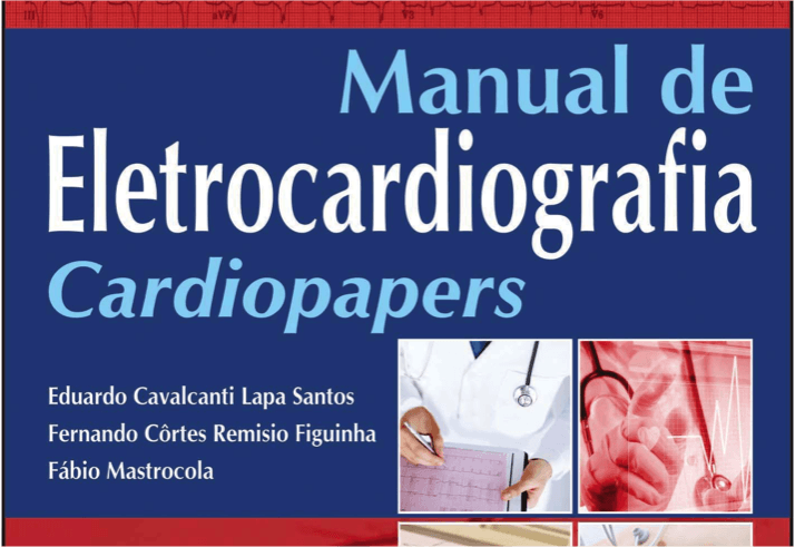 Como medir o supradesnivelamento do segmento ST?