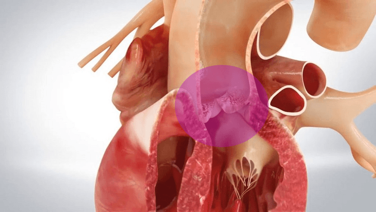 Diretrizes de estenose aórtica em 8 tópicos para não esquecer