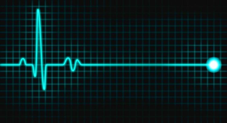 Você sabe como usar marca-passo transcutâneo?