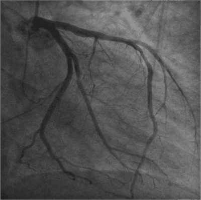 Como saber se uma atividade física é considerada moderada ou intensa?
