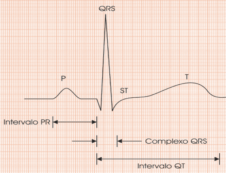 10 dicas que você precisa saber sobre intervalo QT