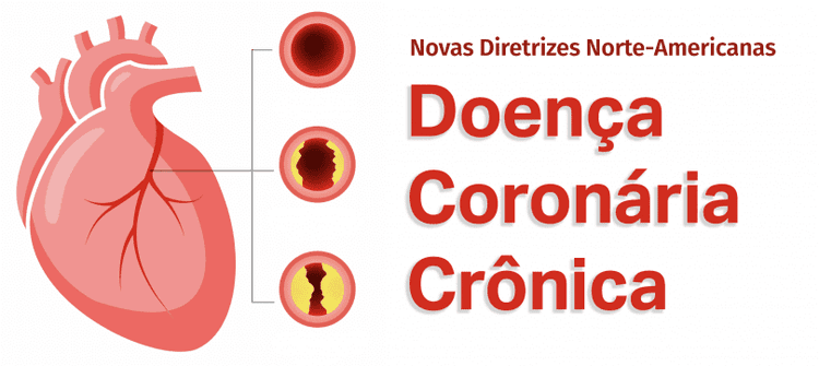 Novas diretrizes para tratamento da Doença Coronária Crônica