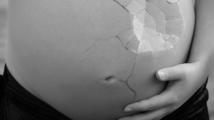 Condutas no trauma em gestantes