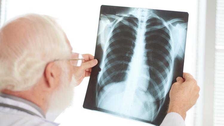 Pneumonia polimicrobiana: o que devemos saber?