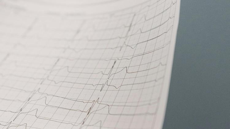 Valor prognóstico da resistência microcirculatória nas lesões intermediárias