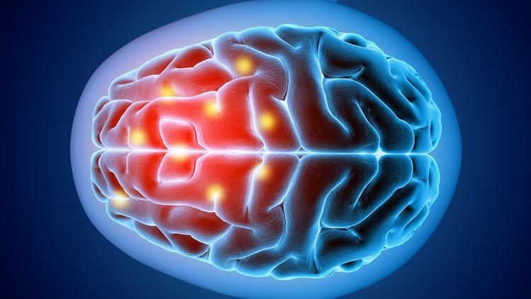 Novas evidências sobre uso de DOAC na trombose venosa cerebral