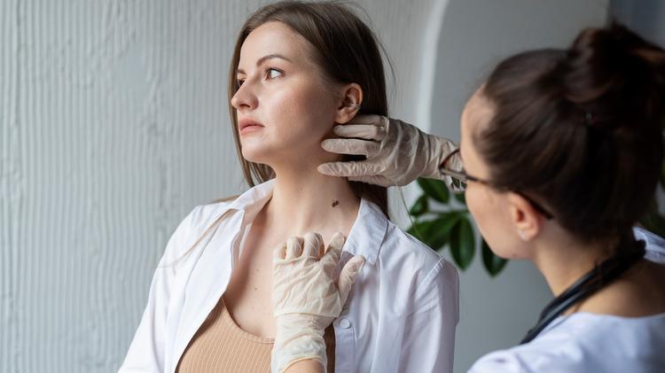 Uso da dermatoscopia no diagnóstico do carcinoma espinocelular