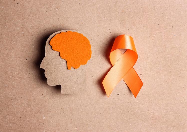 AAN 2025: Atualização dos critérios diagnósticos de McDonald para EM