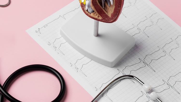 Balão intra-aórtico precoce na IC complicada com choque cardiogênico