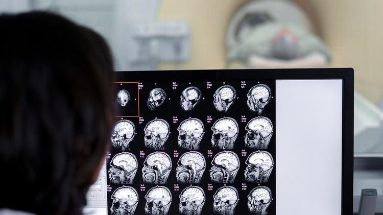 Evidências para indicação de repetir TC de crânio em pacientes com TCE leve