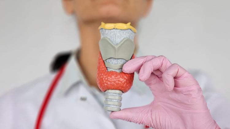 Papel da solução de lugol (SL) nas tireoidectomias por Doenças de Graves (DG)