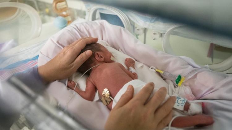 bebê prematuro