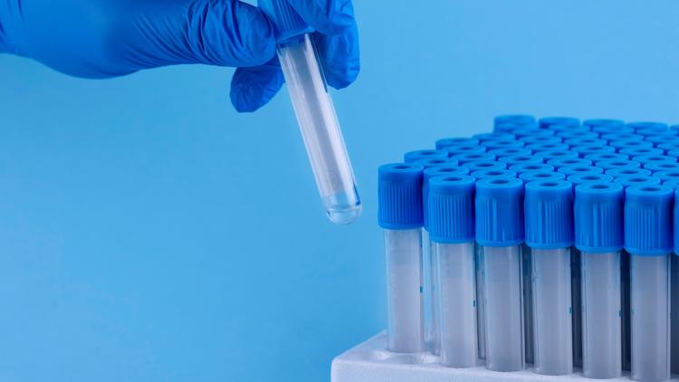 Congressos de DSTs: Rastreamento de ISTs na era da biologia molecular na prática