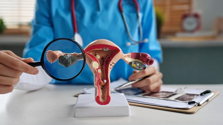 Câncer de endometrio