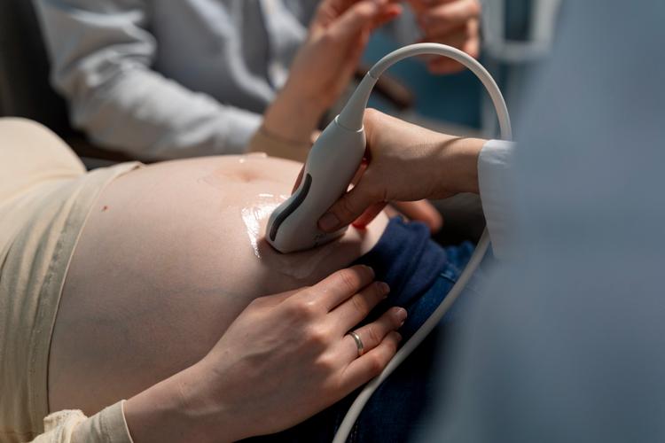 Avaliação fetal após diagnóstico de Artéria Umbilical Única (AUU)