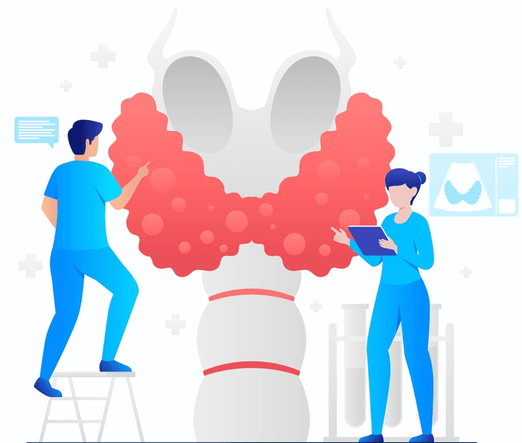 Metotrexato para tratamento da doença de Graves: novo estudo