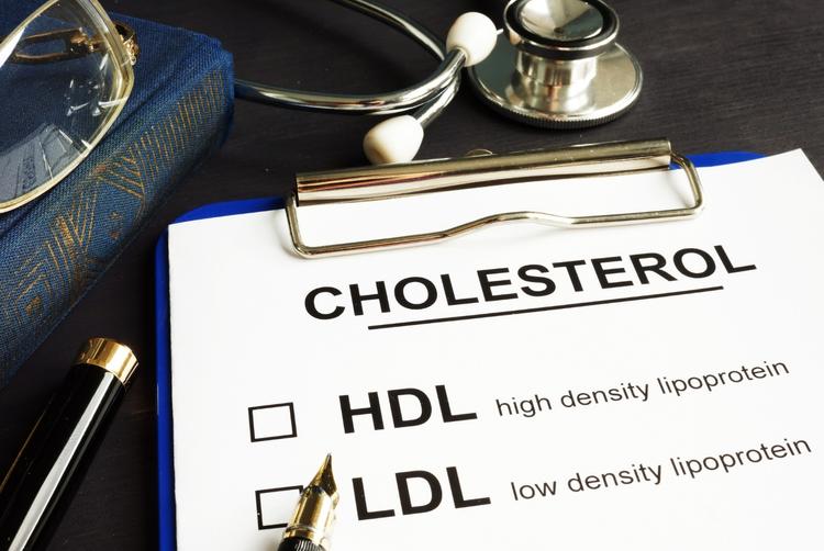 O HDL é fator de risco de doença cardiovascular?