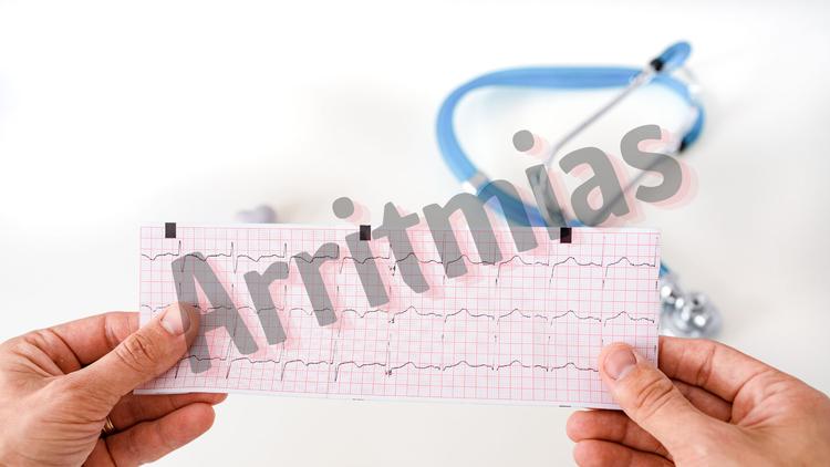 O que há de novidade no CHA 2 DS 2 -VA?