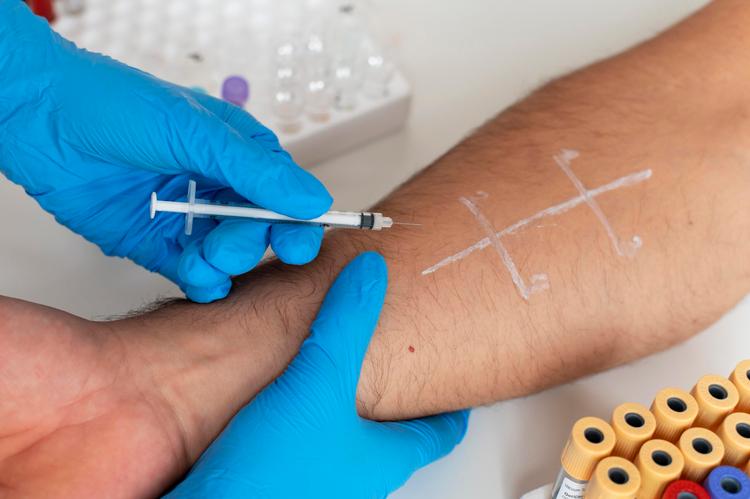 Tratamento das cicatrizes atróficas com insulina subcutânea