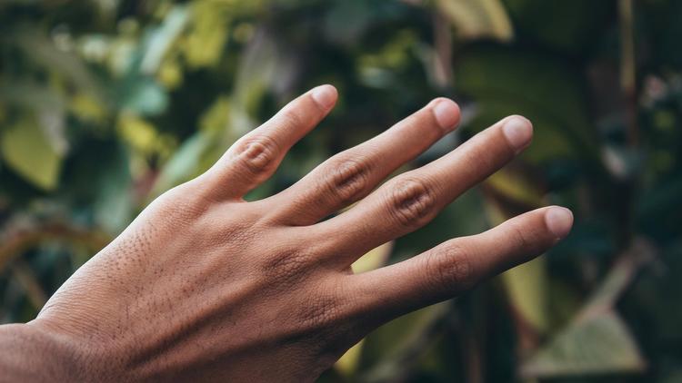 Caso clínico: Unhas da mão com manchas brancas e vermelhas. Qual o diagnóstico?