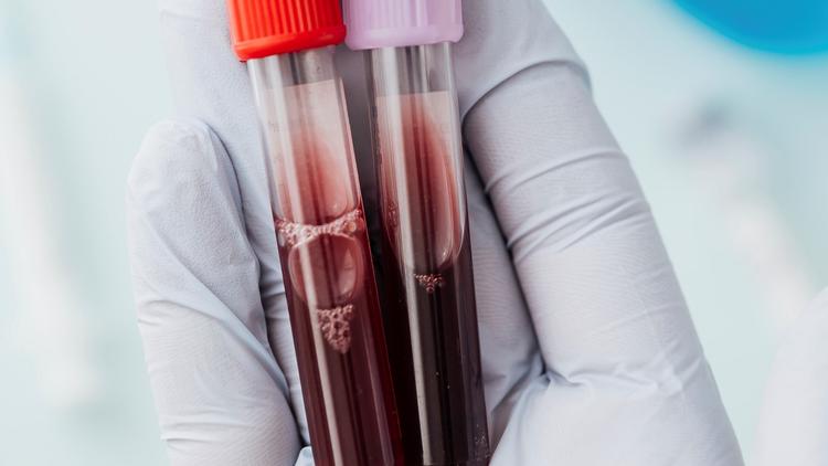 Hemocultura como preditor precoce de endocardite