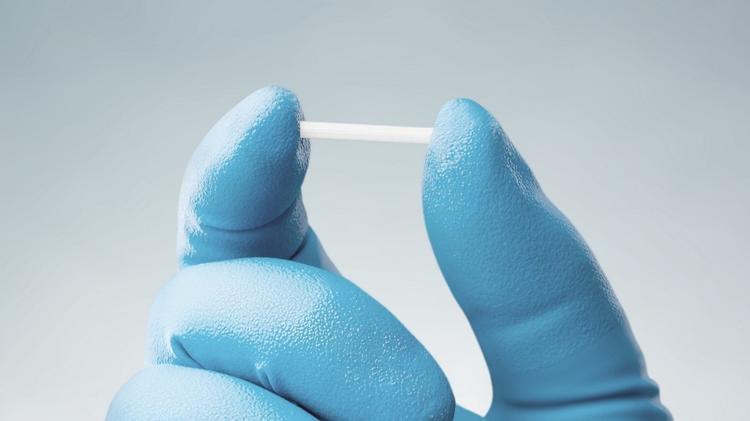 Implante contraceptivo subdérmico de etonogestrel será oferecido pelo SUS