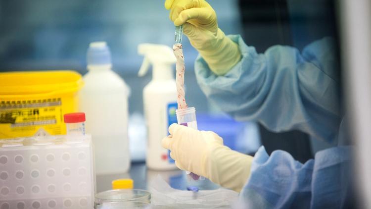 Sepse neonatal precoce: papel do sangue do cordão umbilical