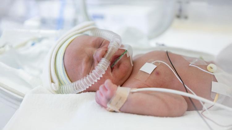 Malformações pulmonares congênitas