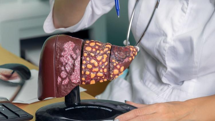 Taxa de recorrência de peritonite bacteriana espontânea em pacientes cirróticos