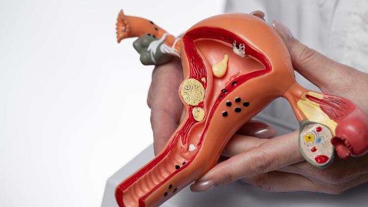 SUS passará a oferecer nova tecnologia para detecção de câncer do colo do útero