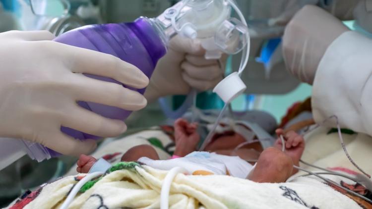 Probióticos na prevenção de PAV em neonatologia