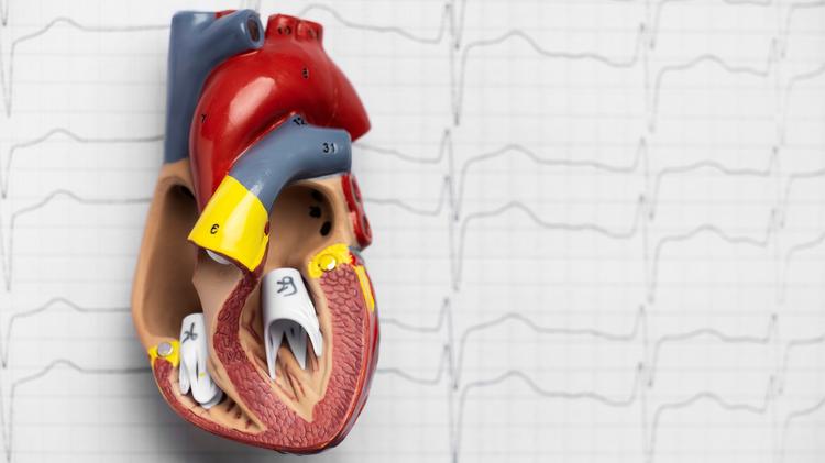Há influência de FAV de alto débito em desfechos cardiovasculares?