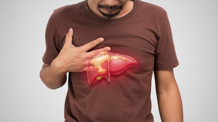 CBCM 2025: Abordagem da Doença Hepática Crônica no PS