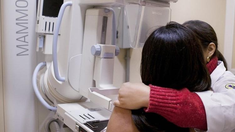 SUS passa a oferecer abemaciclibe para tratamento de câncer de mama precoce