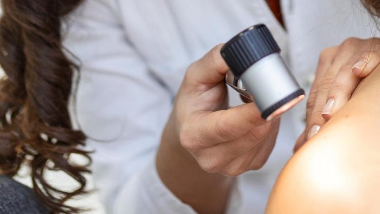 Caso clínico: Lesões no colo de paciente imunossuprimido