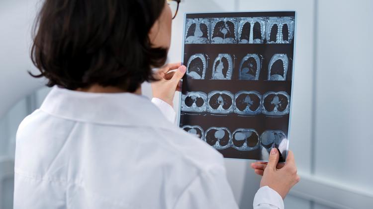 Prognóstico do escore de cálcio incidental na TC tórax