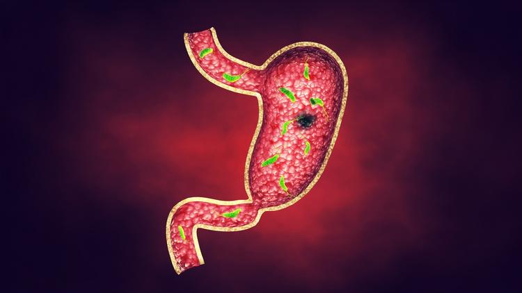 Tratamento do H. pylori em crianças