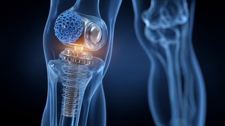 infecção aguda da prótese