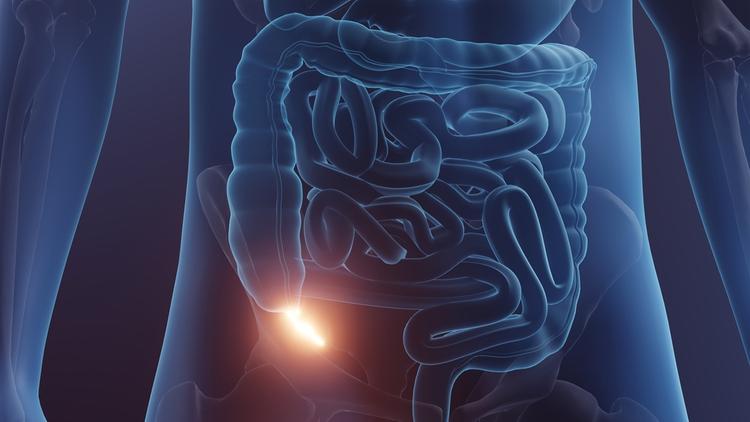 Diferenças no manejo da apendicite inicial e as complicações cirúrgicas