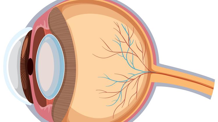 Alteplase na oclusão da artéria central da retina: funciona mesmo?